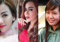 Lakukan Operasi Plastik, Pedangdut Nita Thalia Malah Sempat Alami Kelumpuhan Wajah, Ini Gejalanya!