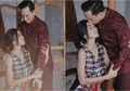 Kulit Berjerawat Setelah Menikah, Kykuu Bersyukur Karena Ge Pamungkas Mengerti Kondisinya