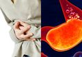 Ini Gejala Asam Lambung Naik, Salah Satunya Bersendawa Terus-menerus
