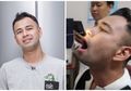 Dimasukkan Alat Medis Lewat Hidung, Begini Kondisi di Dalam Tenggorokan Raffi Ahmad yang Bengkak