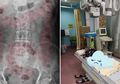 Tak Pernah Memberi Makan Sayuran, Wanita Ini Menyesal Setelah Mengetahui Tubuh Anaknya Menjadi Begini