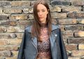 Youtuber Emily Hartridge Tewas Seketika Dalam Insiden Skuter, Ini Penyebab Korban Kecelakaan Lalin Tidak Bisa Tertolong