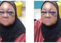 Frustrasi dengan Tangisan Bayinya yang Tak Kunjung Berhenti, Ayah Ini Malah Tega Pukul Nenek Kerabatnya Sendiri hingga Terancam Buta