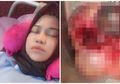 Kurangi-kurangi Makan Fast Foot Jika Tak Ingin Alami Kejadian Mengerikan Seperti Perempuan Ini