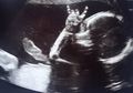 Bayi Ini Tertangkap Lakukan Gestur Tangan 'Metal' Saat dalam Kandungan