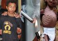 Kisah Pilu DDS, Bayi 2 Tahun Penderita Gizi Buruk yang Sering Disulut Rokok dan Dipukuli Hingga Patah Tulang oleh Ayahnya Hanya karena Sering Menangis