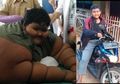 Dulu Sempat Viral dengan Bobot Hampir 200 kg, Aria Permana Kini Sudah Bisa Naik Motor dan Akan Lakukan Operasi Lanjutan Minggu Depan