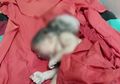 Buat Gempar Dunia Medis, Ibu Ini Lahirkan Bayi dengan 'Tiga Kepala'