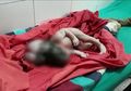 Tak Alami Komplikasi Selama Kehamilan, Seorang Wanita Melahirkan Bayi Perempuan dengan 'Tiga Kepala' yang Memprihatinkan