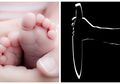 Tragis, Menginginkan Anak hingga Jalani Program Bayi Tabung, Ibu Ini Malah Bunuh Bayinya setelah Lahir