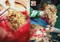 Ibunya Sering Kehilangan Barang, Ternyata Tumpukan Benda Berharga Senilai Rp924 Juta Itu Telah Berpindah ke Perut Putrinya