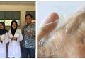 3 Mahasiswi Undip Berhasil Ubah Limbah Tulang Ayam Jadi Pembungkus yang Bisa Dikonsumsi