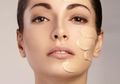 Tips Memilih Foundation yang Cocok untuk Kulit Berjerawat, Sudah Tahu?