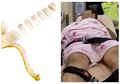 Ngeri! Pernah Diselingkuhi Suami Saat Masih Menikah, Wanita Ini Potong Organ Intim Sang Suami dan Membuangnya ke Toilet!