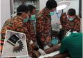 Bingung Melepaskan 'Gear Persneling' yang Tersangkut di Organ Intim Seorang Pria, Petugas Terpaksa Lakukan Hal Ini