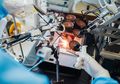 Wah, Teknologi Robotik Bisa Bantu Sembuhkan Stroke, Begini Caranya!