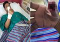 Sering Sentuh 'Tempered Glass' yang Retak, Jempol Pria Ini Alami Kondisi Mengerikan Hingga Dibawa Ke Rumah Sakit