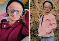 Menua Tujuh Kali Lebih Cepat, Ini Kisah Claudia, Wanita Berusia 20 Tahun yang Terlihat Seperti Berusia 140 Tahun