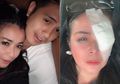 Baru 3 Bulan Nikahi Janda Kaya, Ajun Perwira Singgung KDRT Usai Jennifer Jill Tunjukan Satu Matanya Diperban