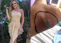 Gara-gara Ingin Terlihat Trendi, Model Ini Hampir Kehilangan Kakinya Karena Sepatu yang Dipakainya
