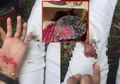 Ingin Buat Kejutan Ulang Tahun Sang Adik, Gadis IniJustru Bernasib Tragis, Kue Hancur, Tubuhpun Penuh Luka