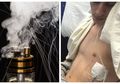 Masih Ngelak akan Bahaya Vape? 22 Orang Jadi Korbannya dan Harus Dirawat di Rumah Sakit