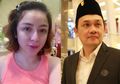 Penampilannya Berubah, Mantan Istri Farhat Abbas Mengaku Rela Menahan Rasa Sakit Selama 3 Hari