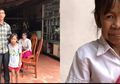 Diserang Penyakit Langka, Bocah Perempuan Ini Alami Penuaan Dini hingga Wajahnya Seperti Usia 60 Tahun