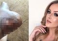 Mengerikan, Hanya Gara-gara Pakai Sepatu, Kaki Model Seksi nan Cantik Ini Terancam Diamputasi