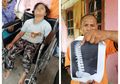 Menyedihkan! Bocah ini Alami Cidera karena Sering Di-Bully Teman Sekolahnya hingga Terpaksa Harus Gunakan Kursi Roda