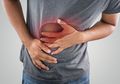 Jauhi Mulai Sekarang, Inilah 5 Makanan yang Tidak Baik untuk Organ Hati, Cegah Sebelum Terlambat