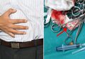 Sakitnya Tambah Parah Usai Operasi Usus, Pria Ini Marah dan Salahkan Dokter Setelah Tahu Penyebabnya