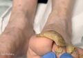 Tak Pernah Potong Kuku Kaki Selama Lebih dari 1 Tahun, Ini Hal Buruk yang Diterima oleh Wanita Ini