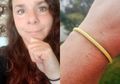 30 Tahun Tak Pernah Lepaskan Karet Gelang di Tangannya, Wanita Ini Berakhir dalam Kondisi Mengerikan