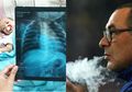 Peringatan! Pneumonia Seperti yang Diidap Maurizio Sarri Juga Bisa Diidap oleh Anak dari Ayah Perokok