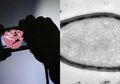 Satu Pria Dalam Video Dewasa ‘Vina Garut’ Positif HIV, Dianggap Mematikan, Nyatanya Virus HIV Tidak Masuk 10 Virus Paling Mematikan di Dunia