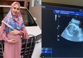 Kartika Putri Berikan Hadiah Spesial Bagi yang Bisa Tebak Jenis Kelamin Janinnya, Vega Darwanti Sampai Ikut Komen!