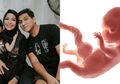 Tak Diduga, Makanan Sehat ini Mengandung Parasit Ganas yang Berisiko Sebabkan Janin Cacat Seperti yang Dialami Tantri Kotak