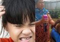 Ibu Ini Basmi Kutu Rambut Anaknya Dengan Semprotan Nyamuk, Padahal Bisa Sebabkan Efek Kematian!