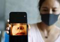 Habiskan Rp 122 Juta untuk Operasi Hidung, Wanita Ini Malah Menanggung Malu karena Ukuran Lubang Hidungnya Tidak Sama