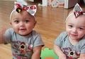 ‘Saya Tidak Melihat Ada Perbedaan Warna,’ Kata Ibu Bayi Kembar yang Lahir dengan Ras dan Warna Kulit yang Berbeda