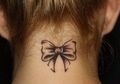Mengenal Laser Tattoo Removal yang Ampuh Hilangkan Tato di Tubuh Secara Permanen