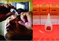 Keliru Meneteskan Obat Tetes Mata dengan Lem Keras, Mata Pria Ini Berakhir Seperti Ini