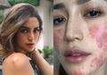Mundur Sementara dari Dunia Hiburan karena Wajahnya Rusak, Jessica Iskandar Syuting Lagi dan Nekat Pakai Kosmetik Ini
