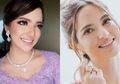 Senyum Cantik dengan Veneer Gigi ala Nia Ramadhani, Kenali Risikonya!
