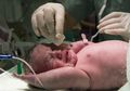 Didiagnosis dan Penanganan Asfiksia Neonatorum yang Dapat Berakibat Fatal Pada Bayi