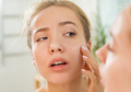 Tips Mengatasi Kulit Rusak Karena Produk Kecantikan, Kamu Wajib Tahu!