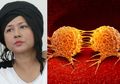 Ria Irawan Alami Metastasis: Faktanya, Kebiasaan Tidur Masyarakat Indonesia Ini Juga Bisa Bikin Sel Kanker Menyebar dengan Cepat dalam Tubuh
