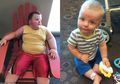 Meski Aktif dan Makan Makanan Sehat, Berat Anak 4 Tahun Ini Terus Bertambah, Ternyata Sindrom Inilah yang Dideritanya