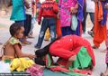Disembah Karena Dianggap Titisan Dewa, Dokter Sebut Anak Ini Alami Kelainan Langka Akibat Polusi, Kok Bisa?
